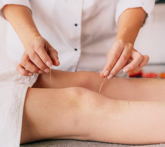 Heal Acupuncture