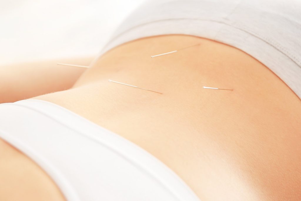 Acupuncture For Female Sexual Dysfunction