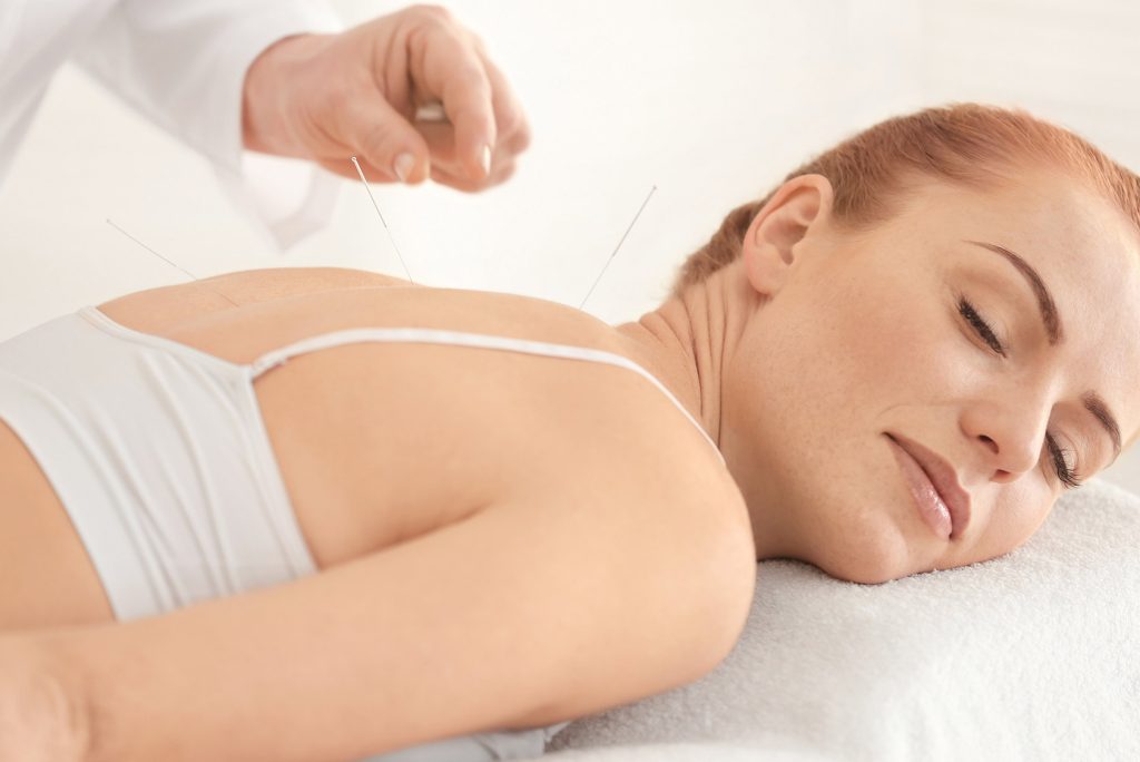 Acupuncture Risks & Benefits + How To Find A Good Acupuncturist