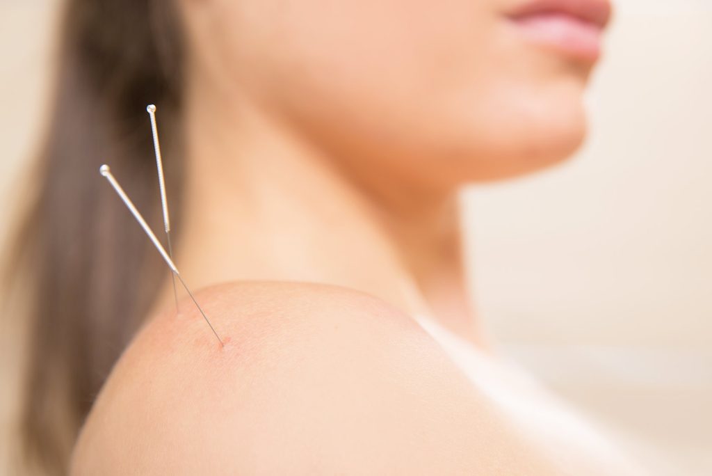 Why Acupuncture Works