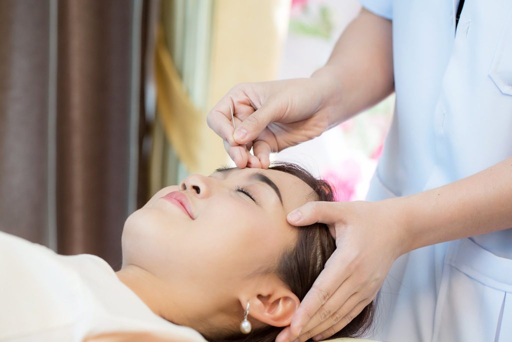 How To Choose An Acupuncturist
