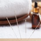 4 Ways Acupuncture Can Make You Feel Better
