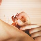 4 Ways Acupuncture Can Make You Feel Better